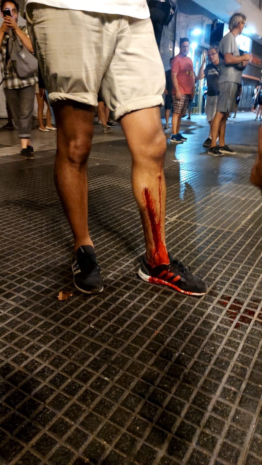 Represión : varios periodistas resultaron heridos por la policía