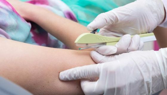 Campaña de Sexualidad Responsable: hoy colocarán implantes subdérmicos en la Usina Cultural
