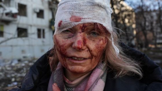 Una mujer herida por un ataque aéreo ruso que dañó departamentos en Kharkiv, Ucrania